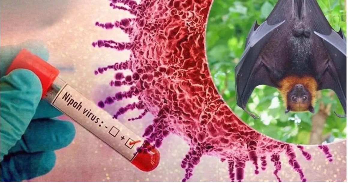 Nipah Virüsü: Covid-19'un Kuzeni Hakkında Yorumlar
